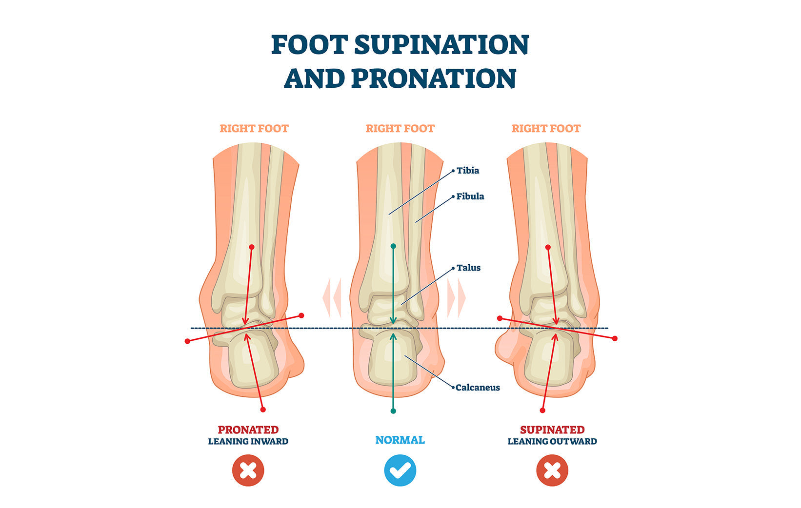 Supination